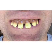 Fake funny looking Teeth