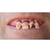Ugly Teeth